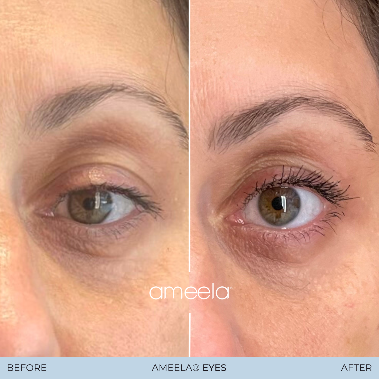 Copy of Copy of Ameela Eyes - Before_After 05